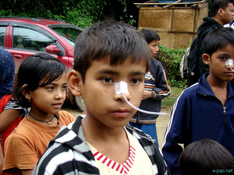 Children depicts forceful nose feeding of Irom Chanu Sharmila at Sangaithel :: Nov 4 2012