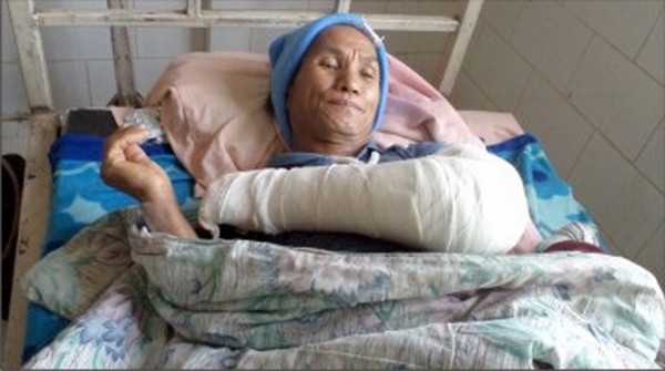 The injured Baite at a hospital
