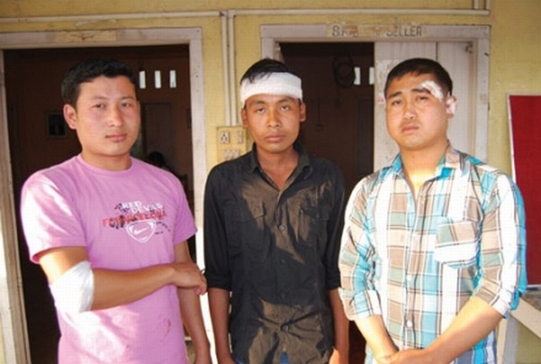 MSF volunteers K Romeo (L), T Arunkumar(C), A Boynao who faced the ire of a restaurant owner
