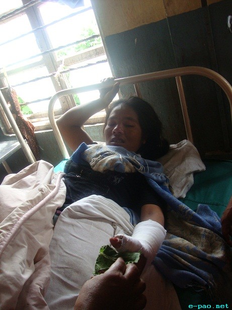 SHDDC bandh supporter injured on 6th September evening incident at Kangpokpi :: September 06 2011